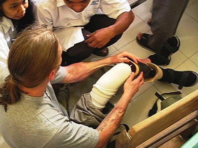 Zespół medyczny pomagający człowiekowi z jego protezą nogi.